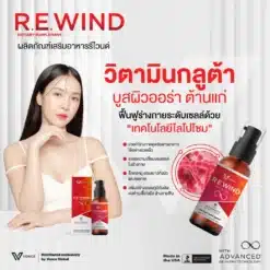 rewind